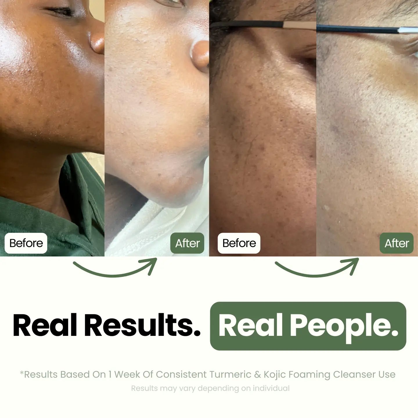 Turmeric & Kojic Foaming Cleanser